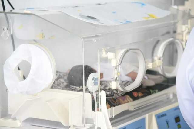 Bayi Lahir Dengan Kelainan, Bupati Tapsel Perintahkan Agar Ditangani Maksimal Bupati